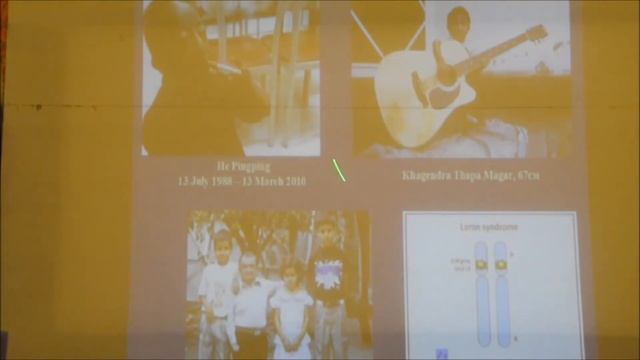 Патологічна фізіологія №11 Патофізіологія ендокринної системи; гіпоталамус гіпофіз, щитовидна, пара смотреть онлайн