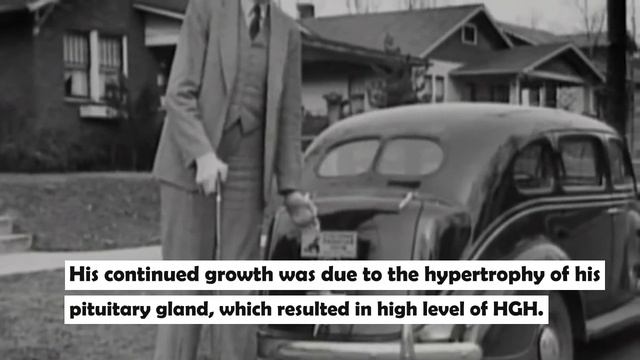 Robert Wadlow | Tallest Person In Recorded History | Officially Incredible | Record Owner смотреть онлайн