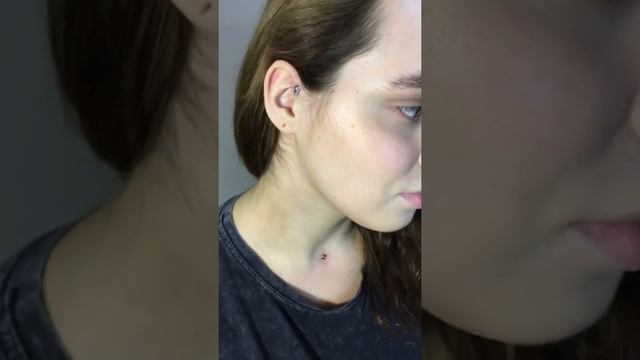 Микродермал и антихеликс смотреть онлайн