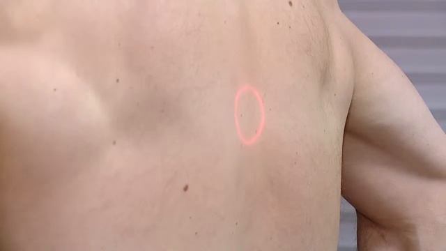 КАК РАСПОЗНАТЬ ТУБЕРКУЛЕЗ 18.04.19 смотреть онлайн