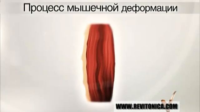 Ревитоника - образование морщин