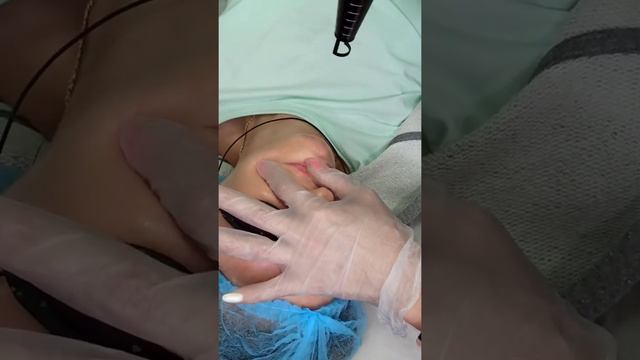 Лазерное удаление некачественного татуажа губ, за пределами губ. Мастер Светлана Яковенко Оренбург смотреть онлайн