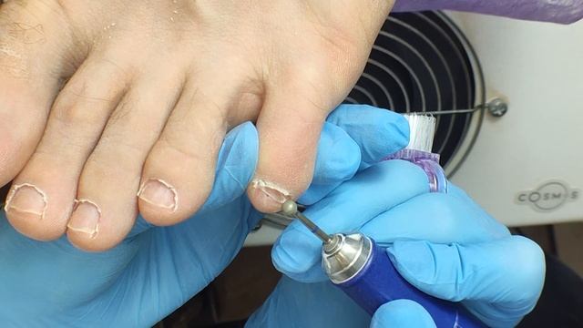 МУЖСКОЙ ПЕДИКЮР. ПОДРОБНАЯ ОБРАБОТКА ПАЛЬЧИКОВ. ГИГИЕНИЧЕСКИЙ ПЕДИКЮР. PEDICURE. MEN'S PEDICURE, 腳趾 смотреть онлайн