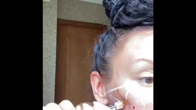 Волюмизация ( восполнение утраченных объёмов) смотреть онлайн