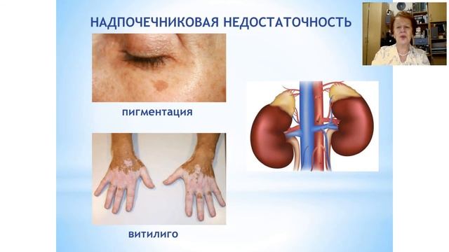 Кожные заболевания. смотреть онлайн