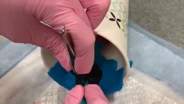 Word Catheter Placement