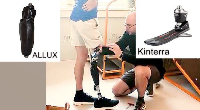 Протез ноги: хорошая стопа + отличная коленка смотреть онлайн