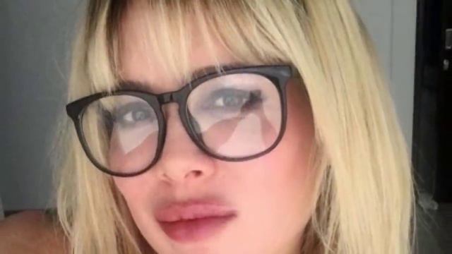 ASI VIVE EL GATO JUAN ALFONSO BAPTISTA'' CON SU ROSTRO DERECHO PARALISADO'' смотреть онлайн