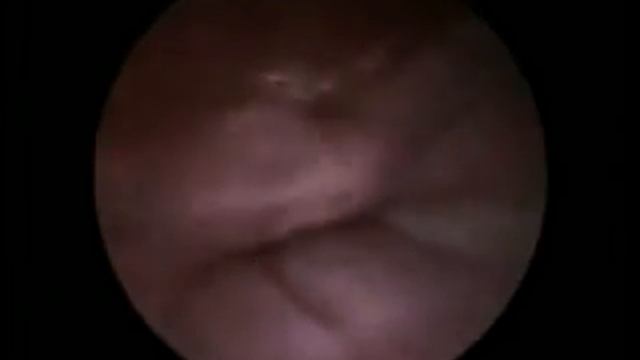 Шейка матки у собаки. Открытие.Курган. www.endovet.su смотреть онлайн