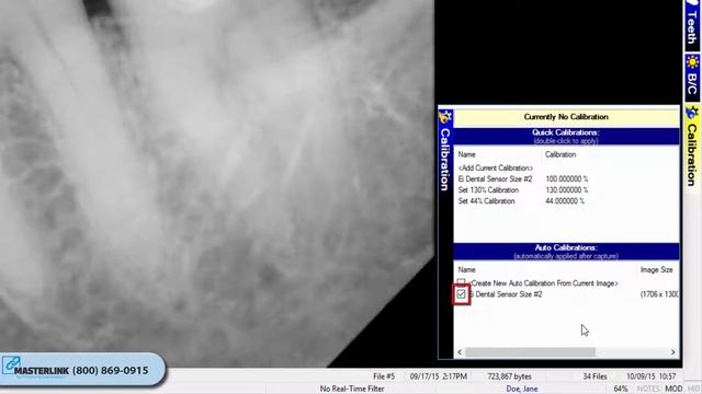 Apteryx XrayVision Labeling Images - Apex Dental Sensors - Training смотреть онлайн