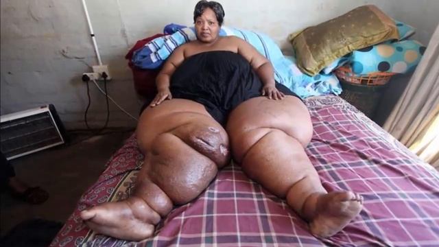 Топ 5 самых страшных болезней в мире . смотреть онлайн