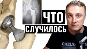 Саня во Флориде. Замена тазобедренного сустава. Как прошла операция.