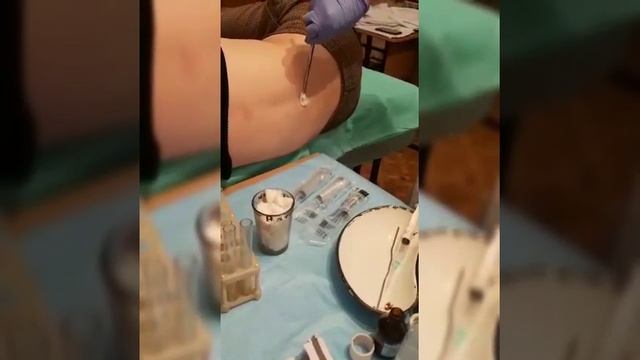 Люмбальная пункция. Основы сестринского дела. смотреть онлайн