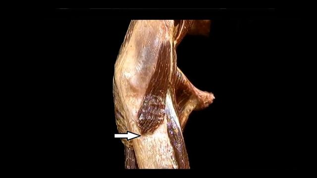 Напрягатель широкой фасции бедра Musculus tensor fasciae latae смотреть онлайн