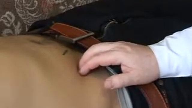 Palpation of cecum смотреть онлайн