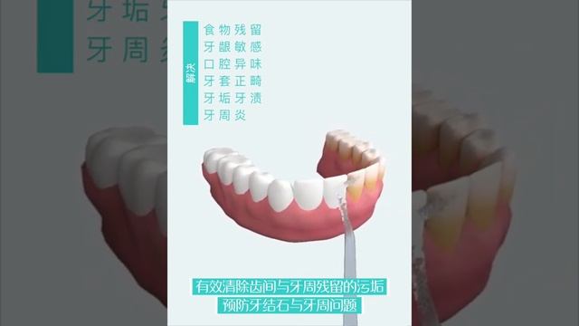 Portable USB Rechargeable Oral Irrigator Tooth Cleaner Dental Irrigator Water Flosser смотреть онлайн