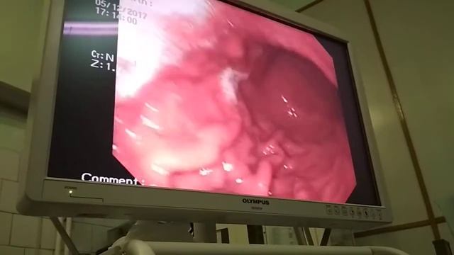 Желудок изнутри смотреть онлайн