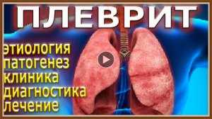 ПЛЕВРИТ - ЛЕЧЕНИЕ НАРОДНЫМИ СРЕДСТВАМИ.mp4