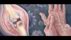 Биоэнергомассажер Fohow  Чудо или нет -  решать Вам