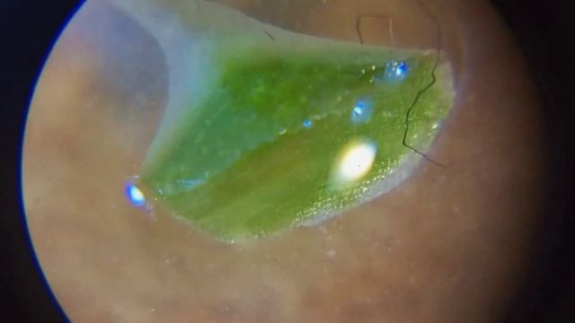 ?КУСОЧКИ ЛИСТЬЕВ ПОД МИКРОСКОПОМ!? смотреть онлайн