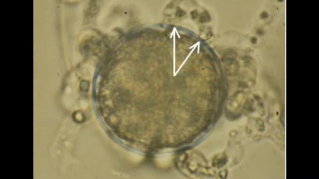 Aphanomyces root rot of pulses смотреть онлайн