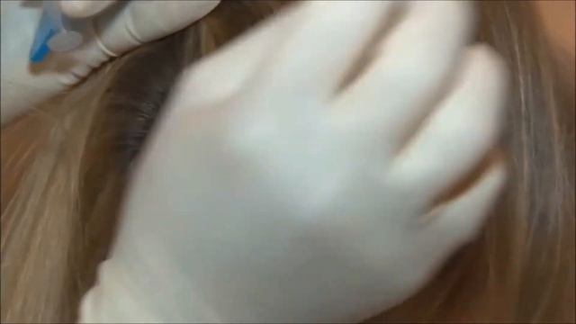 Revitacare - HAIRCARE - Live injection DEMO смотреть онлайн