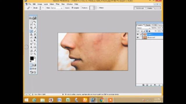 #5 How to remove pimples | Adobe photoshop tutorial bengali | Prince sujan смотреть онлайн
