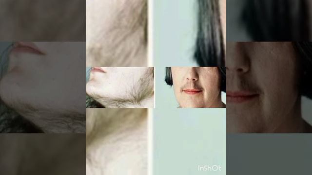 Юздаги доғ, ҳуснбузар, акне. смотреть онлайн