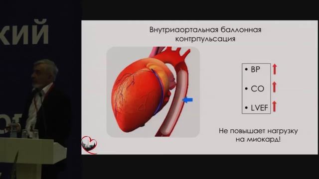 Шок при остром инфаркте миокарда Шпектор А.В. 2017 смотреть онлайн