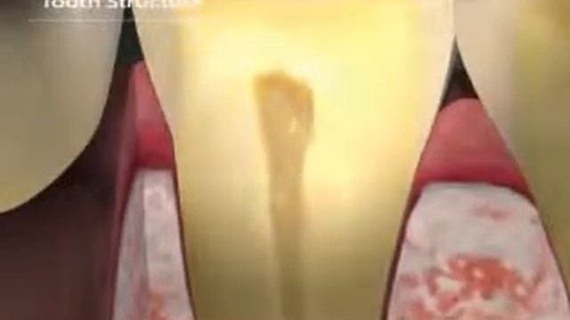 Строение зуба смотреть онлайн