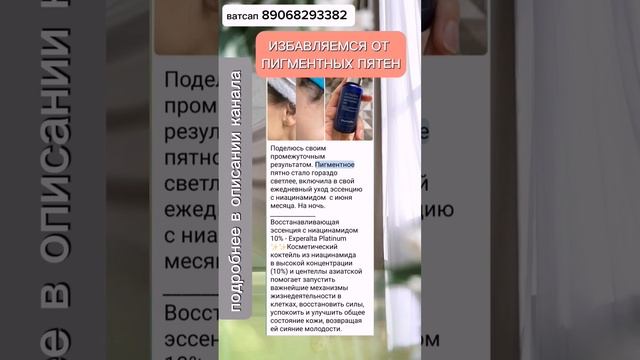 КАК ИЗБАВИТЬСЯ ОТ ПИГМЕНТНЫХ ПЯТЕН? #пигментныепятна #здоровье смотреть онлайн