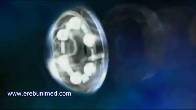 Capsule endoscopy arm final смотреть онлайн