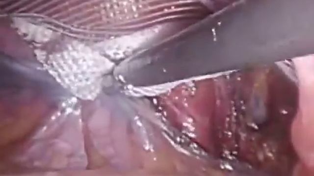 Загадочное союзное умение с энергией