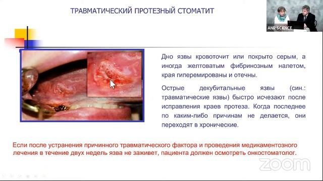 Особенность ортопедического лечения пациентов с сахарным диабетом 2-го типа смотреть онлайн
