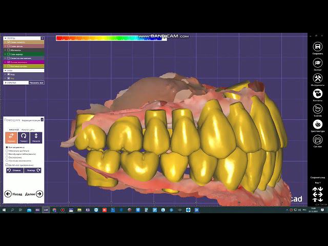 Моделирование в программе Exocad смотреть онлайн