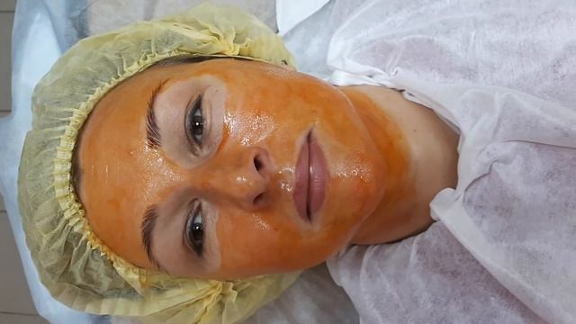 Ретиноевый пилинг лица смотреть онлайн