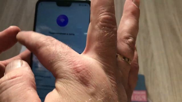 Распаковка HUAWEI P20 lite смотреть онлайн