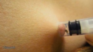 Можно ли вытащить КЛЕЩА шприцом Эксперимент КАК вытащить КЛЕЩА How to Remove a tick