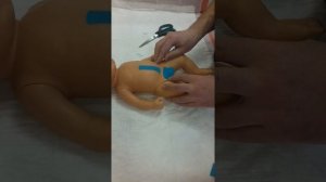 Надо ли заклеивать пупочную грыжу? 30 апреля 2020 г.