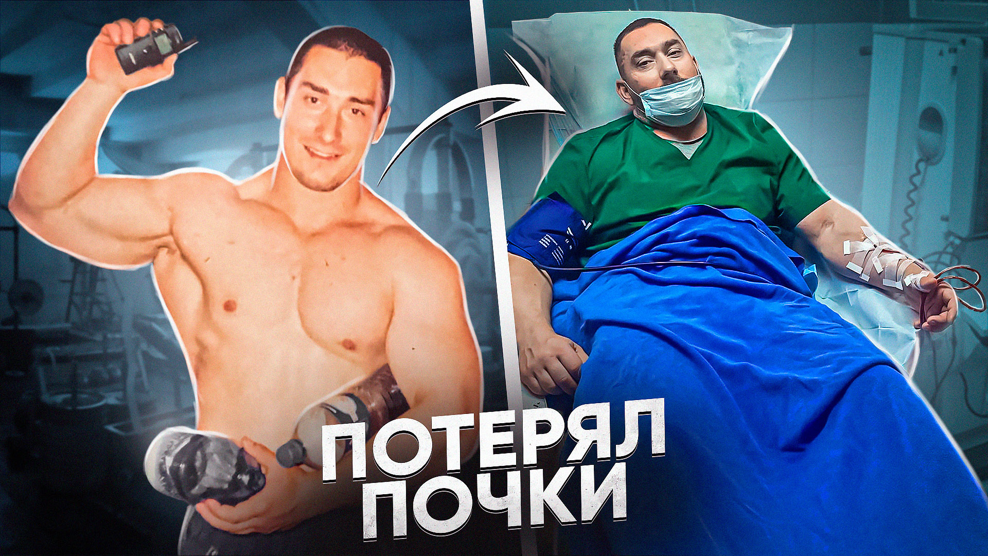 ИСТОЩИЛ ПОЧКИ ХИМИЕЙ И СНЯЛСЯ В ПОРНО / Сергей Родин смотреть онлайн