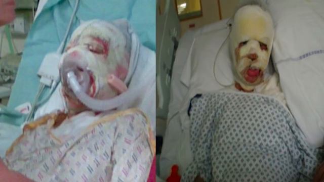 The Heartbreaking Case of Katie Piper смотреть онлайн