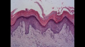 Собственно соединительные ткани. Гистологические препараты