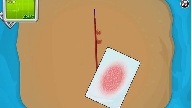 Установка кардиостимулятора