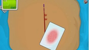 Установка кардиостимулятора