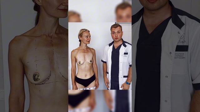 Маммопластика. Старков Г.С.