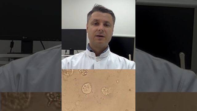 Живые трихомонады смотреть онлайн