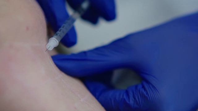 Поставяне на мезоботокс на шия смотреть онлайн