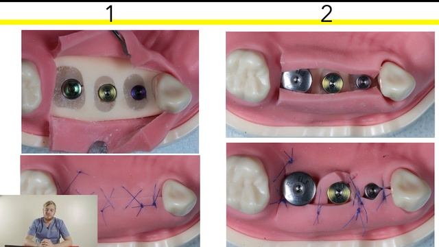 Видео для начинающих №5. Про швы, заглушки и формирователи.