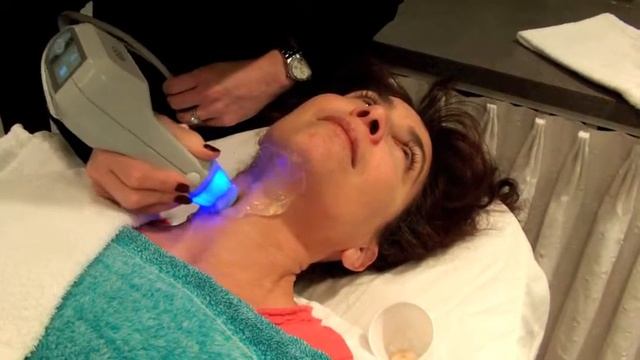 Exilis Body Contouring With SCG Skin Rejuvenation