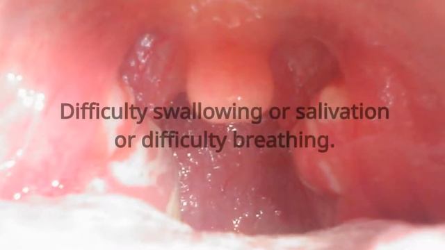 You find a swollen lymph node in your baby's neck. When do you have to worry? смотреть онлайн